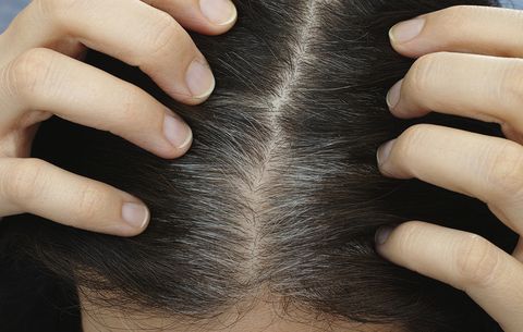 Do you suffer from gray hair? Try this with a few potato peels!  