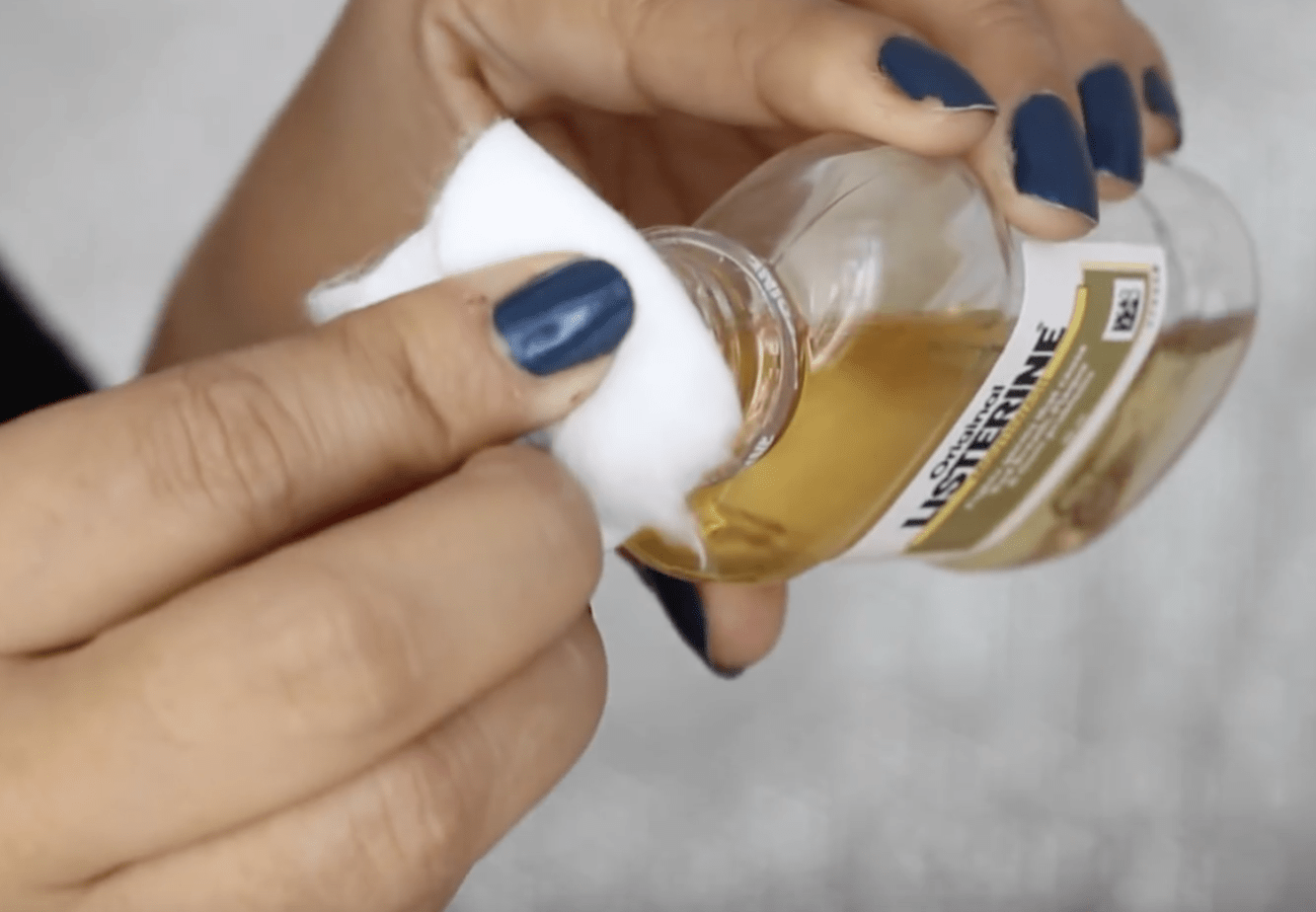 She applied listerine to her face and the result is incredible!