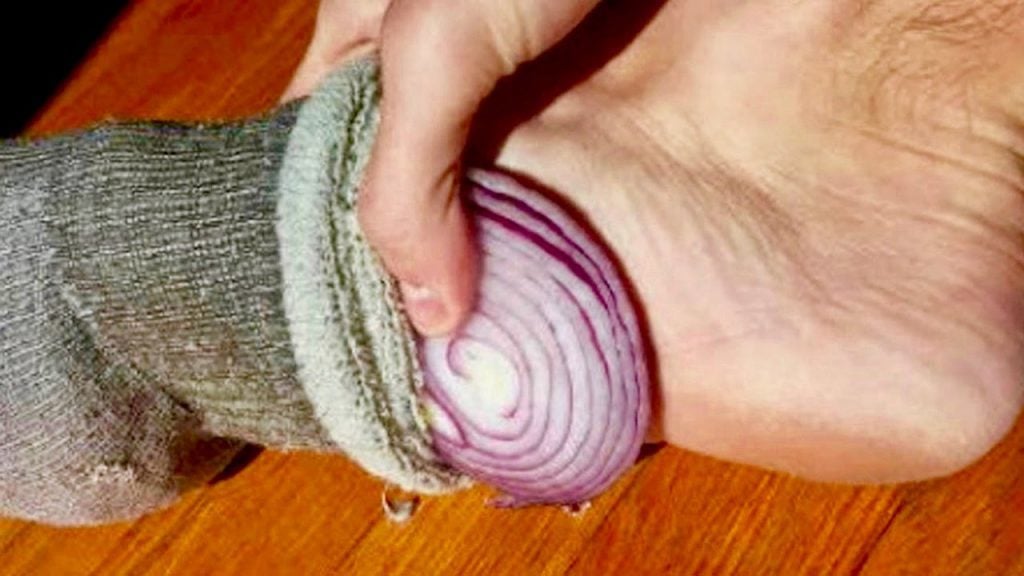 Put an onion in your sock at night and this is what happens after a week!